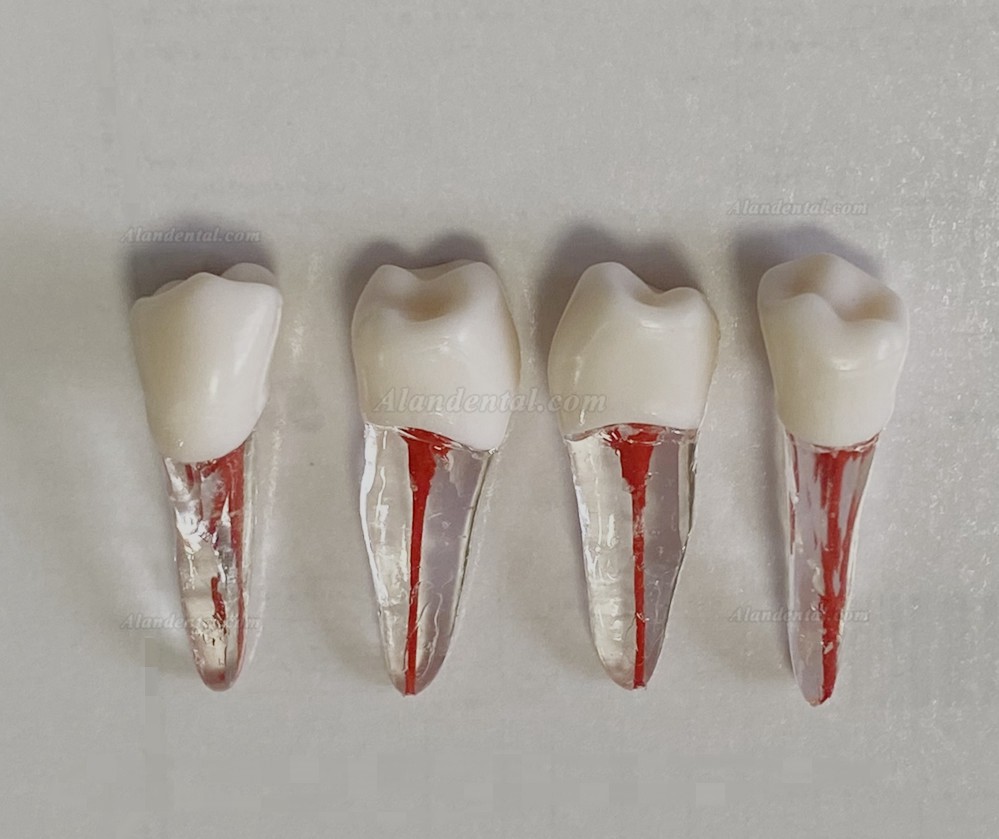 Dental Teeth Model Endo Files Practise Molar Upper Lower Tooth Premolar Root 2/3-Rooted Canal